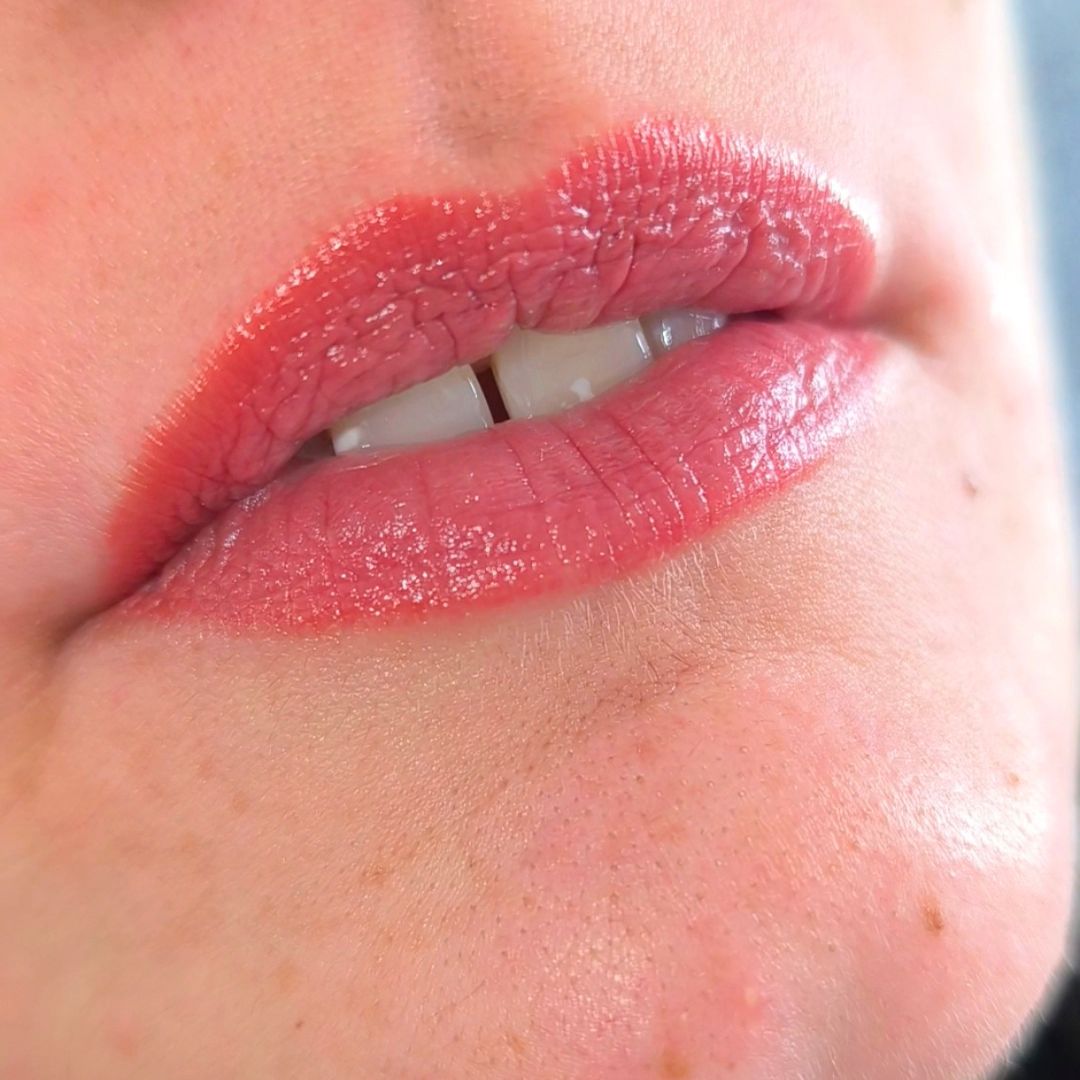 Consultation dermopigmentation image